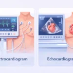 electrocardiogram vs echocardiogram